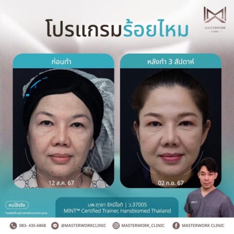 LINE_ALBUM_New ร้อยไหม_250407_2