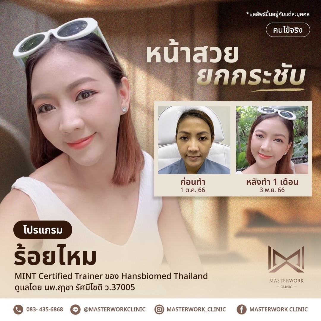 LINE_ALBUM_New ร้อยไหม_250407_3