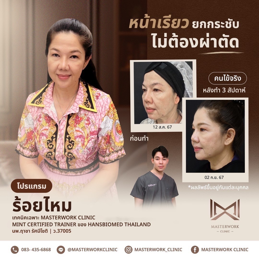 LINE_ALBUM_New ร้อยไหม_250407_4