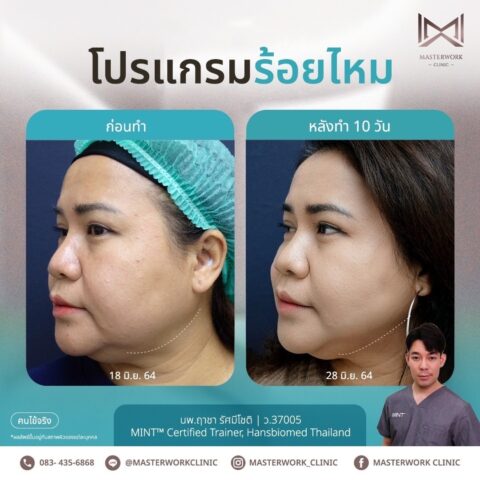 LINE_ALBUM_New ร้อยไหม_250407_8