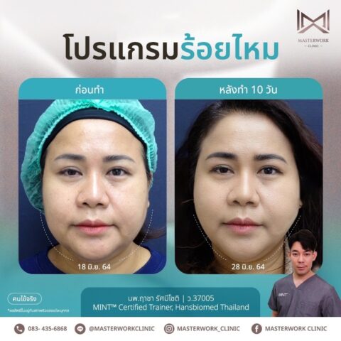 LINE_ALBUM_New ร้อยไหม_250407_9