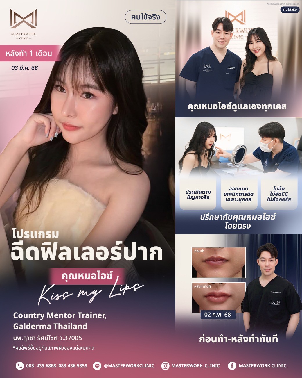 LINE_ALBUM_New โปรแกรมฟิลเลอร์_250811_5