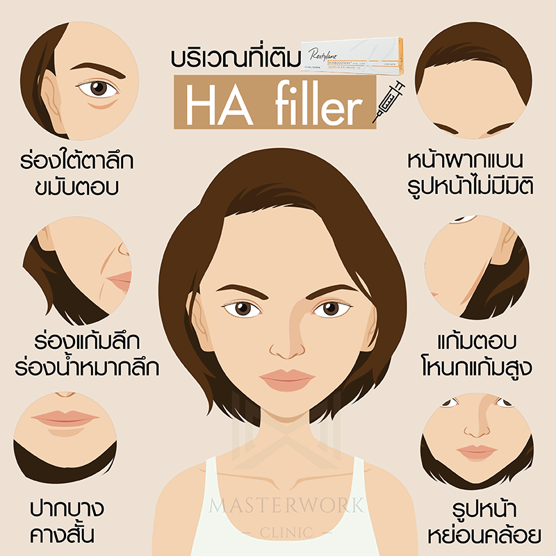filler--masterworkclinic48