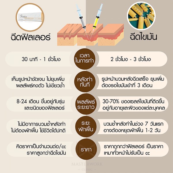 ฉีดไขมัน ไขมันตัวเอง ฉีดไขมันหน้าเด็ก masterwork clinic00025