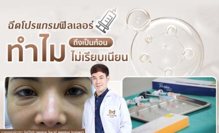 ฉีดโปรแกรมฟิลเลอร์ใต้ตาเป็นก้อน เจาะลึกสาเหตุ วิธีแก้ไข และป้องกันภาวะนี้ได้อย่างไร?