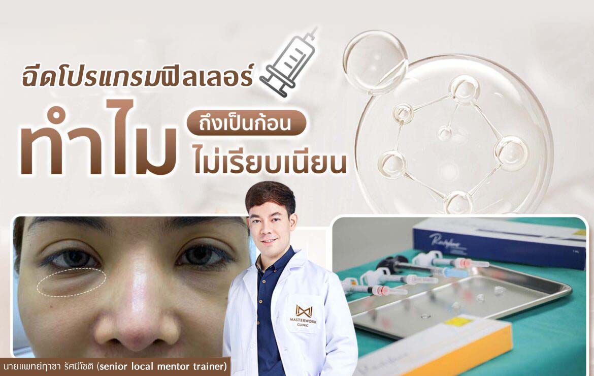 ฉีดโปรแกรมฟิลเลอร์ใต้ตาเป็นก้อน เจาะลึกสาเหตุ วิธีแก้ไข และป้องกันภาวะนี้ได้อย่างไร?