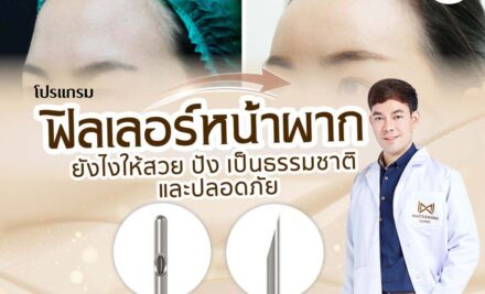 ฉีดโปรแกรมฟิลเลอร์หน้าผาก ยังไงให้สวย ปัง เป็นธรรมชาติ และปลอดภัย