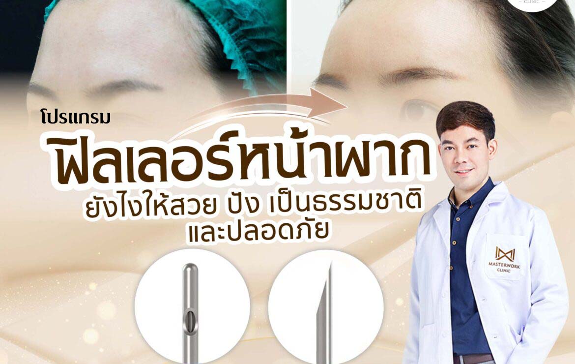 ฉีดโปรแกรมฟิลเลอร์หน้าผาก ยังไงให้สวย ปัง เป็นธรรมชาติ และปลอดภัย