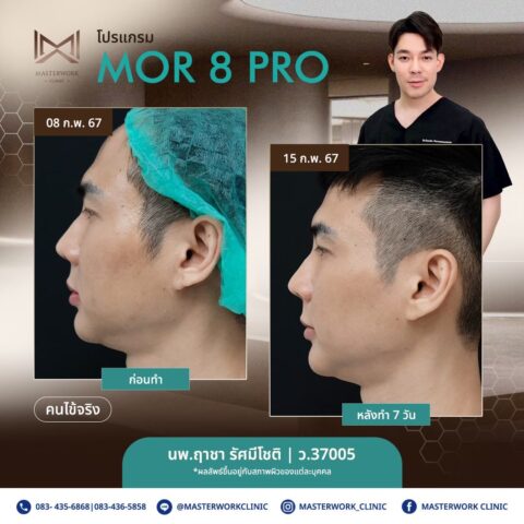 LINE_ALBUM_New Mor 8_250811_2