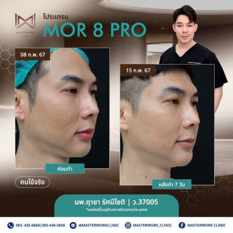 LINE_ALBUM_New Mor 8_250811_3