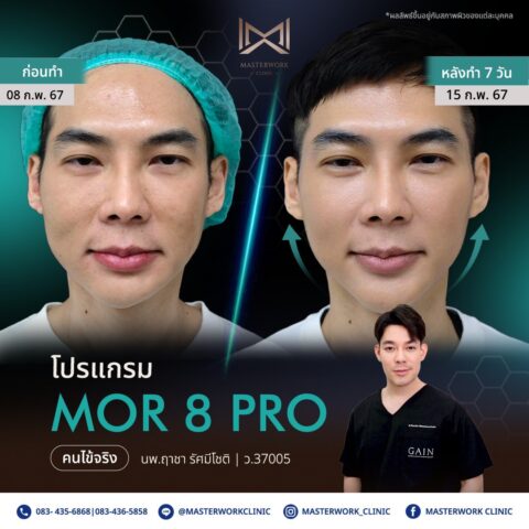 LINE_ALBUM_New Mor 8_250811_4