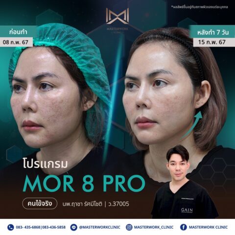 LINE_ALBUM_New Mor 8_250811_5