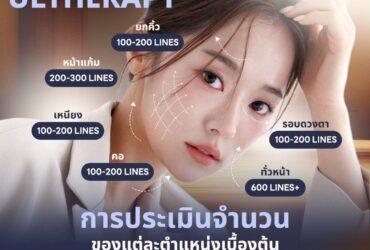 โปรแกรม ULTHERAPY ยกกระชับปรับรูปหน้า