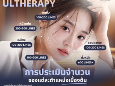 โปรแกรม ULTHERAPY ยกกระชับปรับรูปหน้า