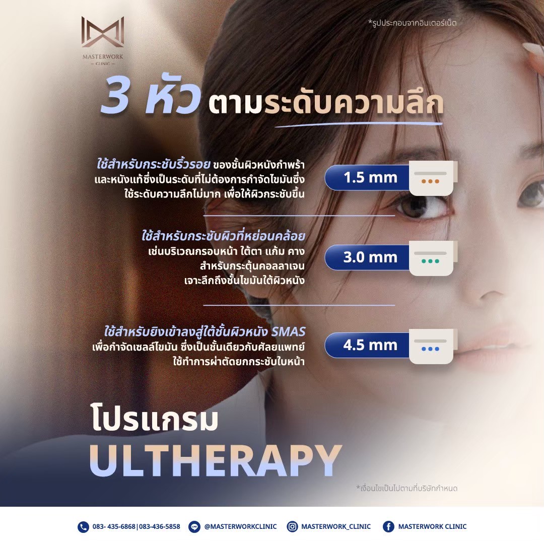 ULTHERAPY