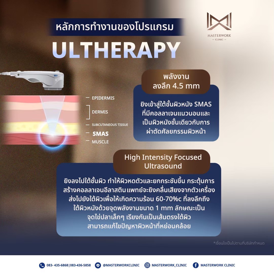 LINE_ALBUM_New Ultralift_251109_9