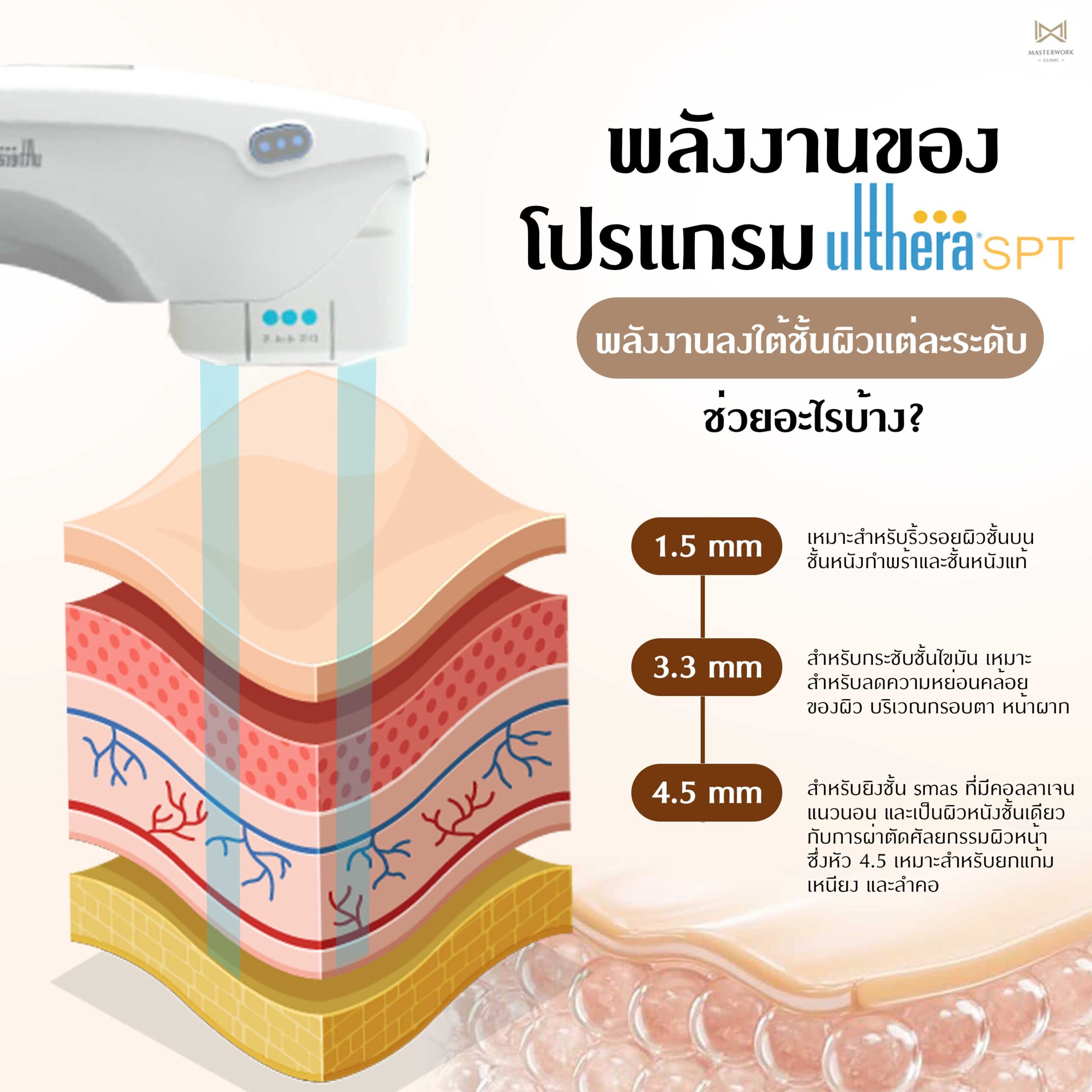 หัวระดับความลึก Ulthera SPT, Ulthera SPT ช่วยอะไร