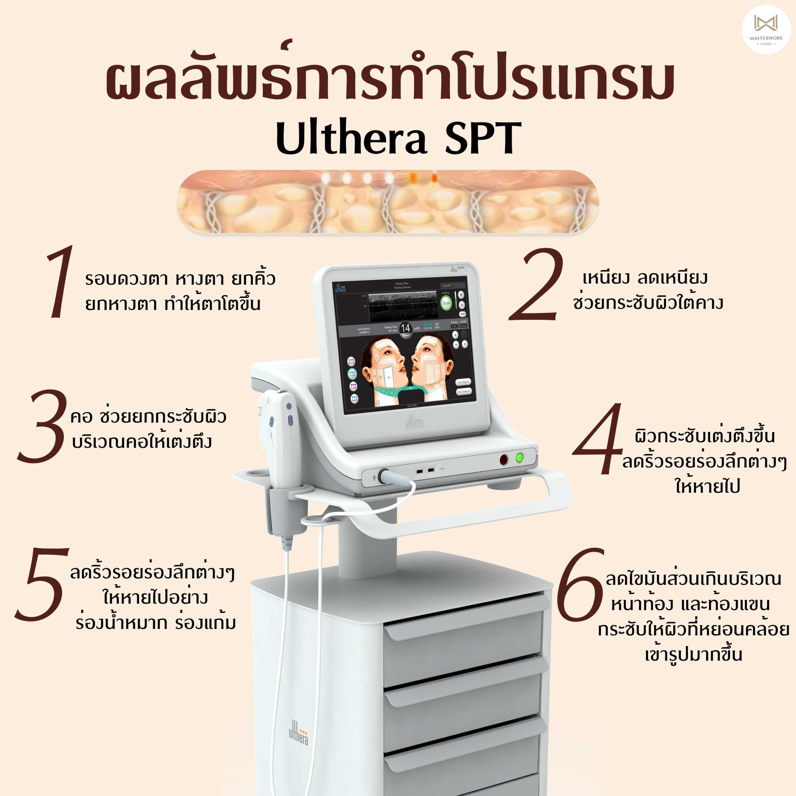 ผลการทำ Ulthera SPT, หลักทำ Ulthera SPT