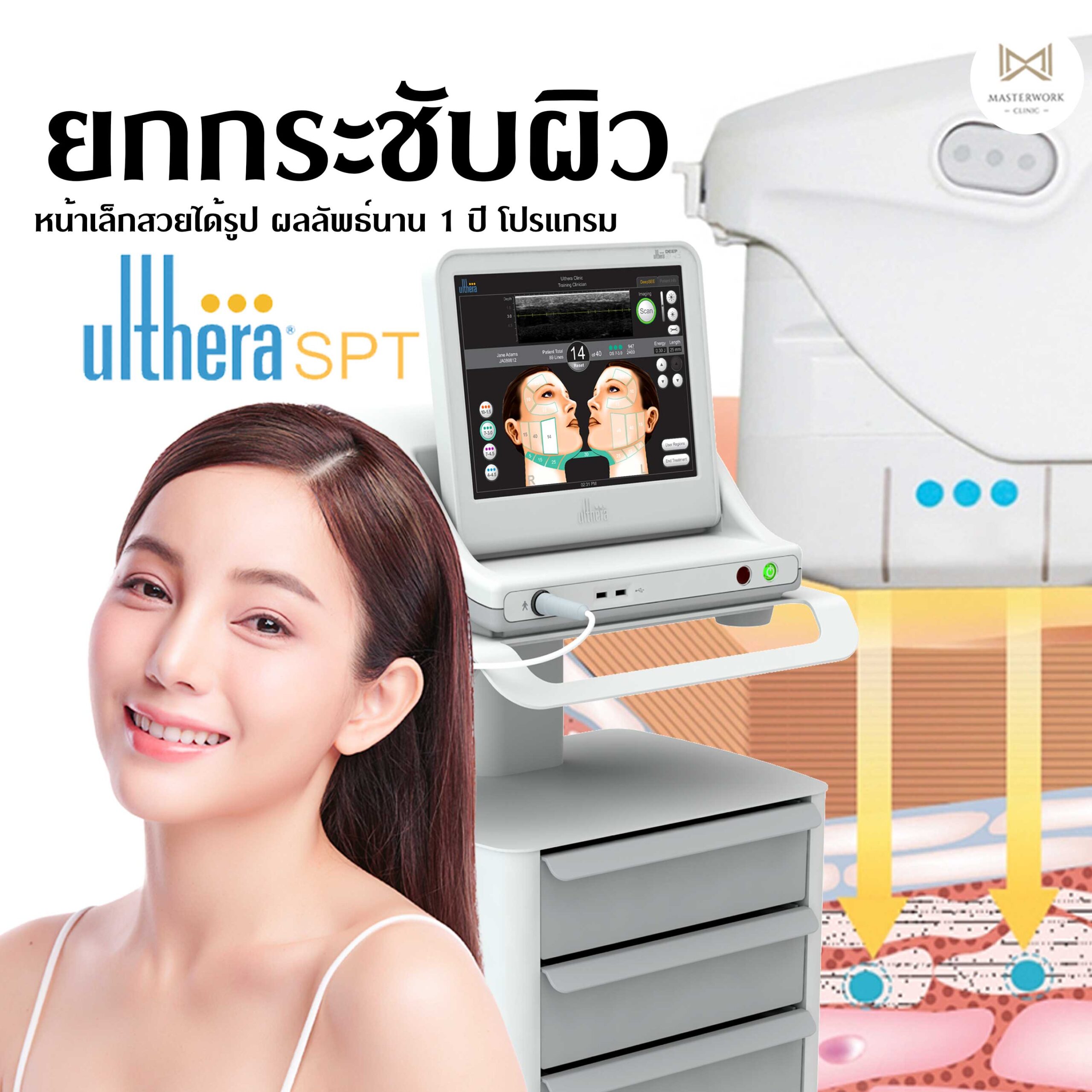 Ulthera SPT, โปรแกรม Ulthera SPT