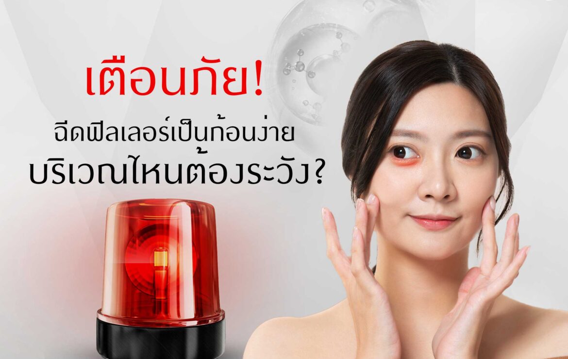 เตือนภัย!!! ฉีดโปรแกรมฟิลเลอร์เป็นก้อนง่าย บริเวณไหนต้องระวัง?