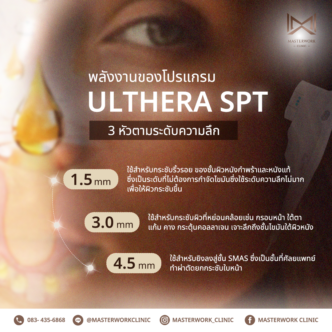 Masterwork_พลังงาน ULTHERA SPT