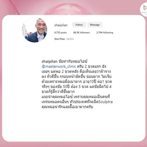 รีวิว-sculptra