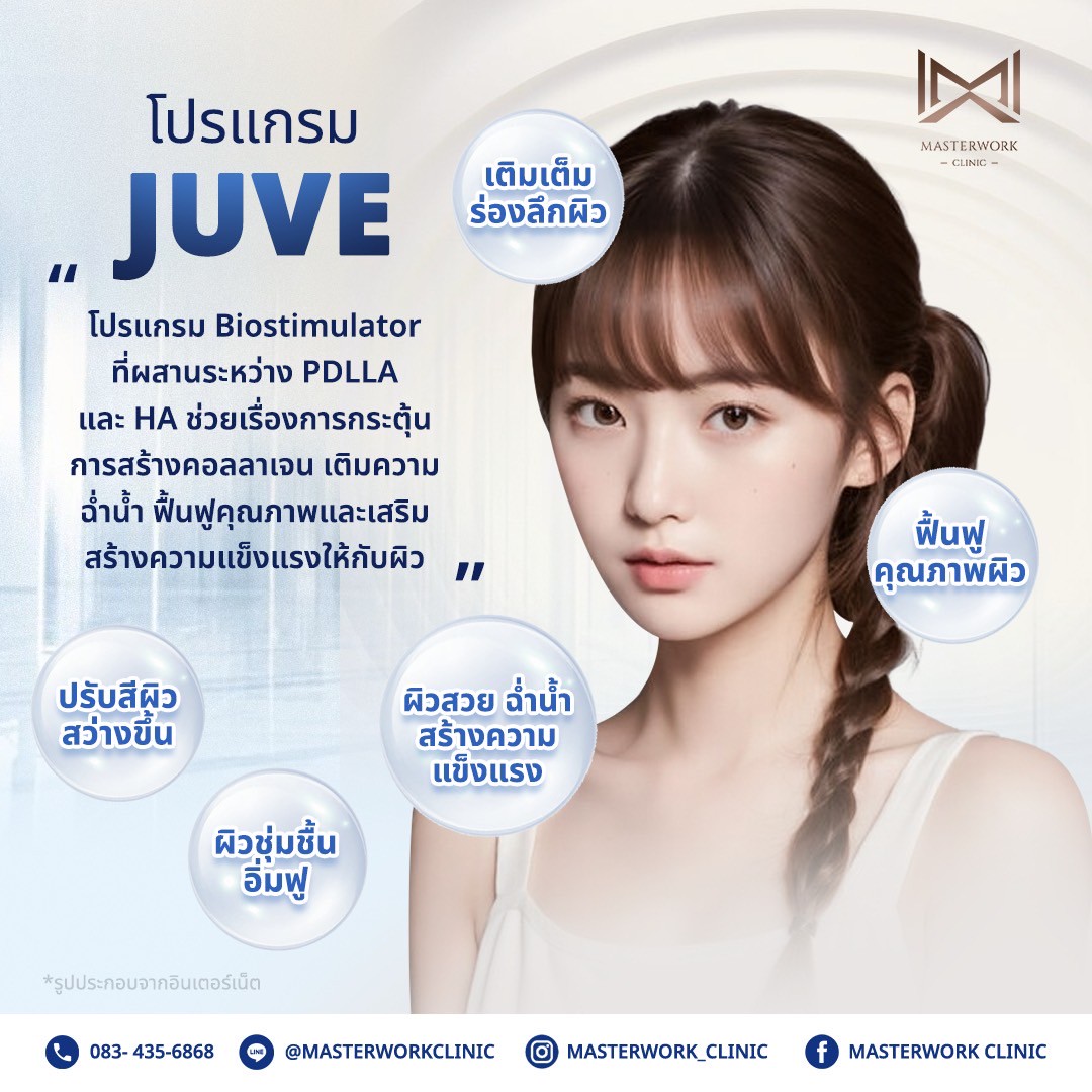 JUVE