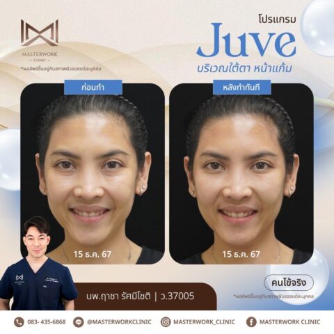 LINE_ALBUM_New JUVE_250327_4