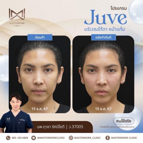 LINE_ALBUM_New JUVE_250327_5