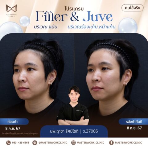 LINE_ALBUM_New JUVE_250327_9