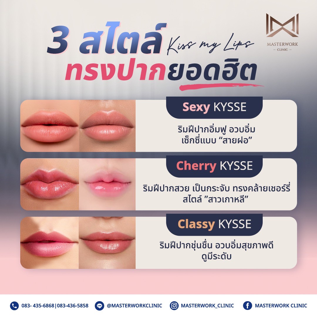 ฟิลเลอร์ปาก masterworkclinic