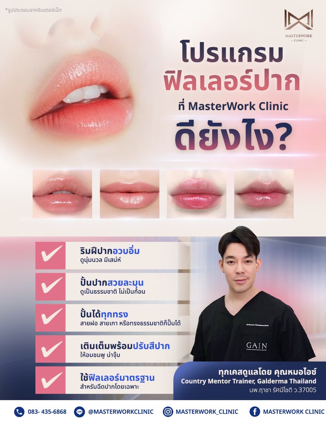 ฟิลเลอร์ปาก masterworkclinic